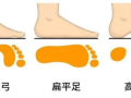 【義診預(yù)告】千里之行，始于“足”下，扁平足免費篩查來了