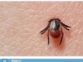 隨州市中心醫(yī)院提醒：小小蜱蟲(chóng)需警惕！——發(fā)熱伴血小板減少綜合征科普知識(shí)